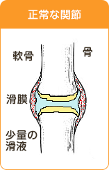 正常な関節